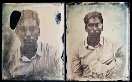 Silver nitrate issue